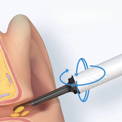 Safe-Reach Ear Hygiene - CrispVoice